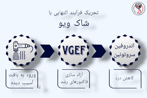 شاک ویو