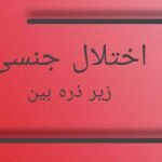 اختلال جنسی